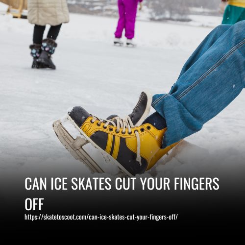 Read more about the article Can Ice Skates Cut Your Fingers Off? Risk & Safety